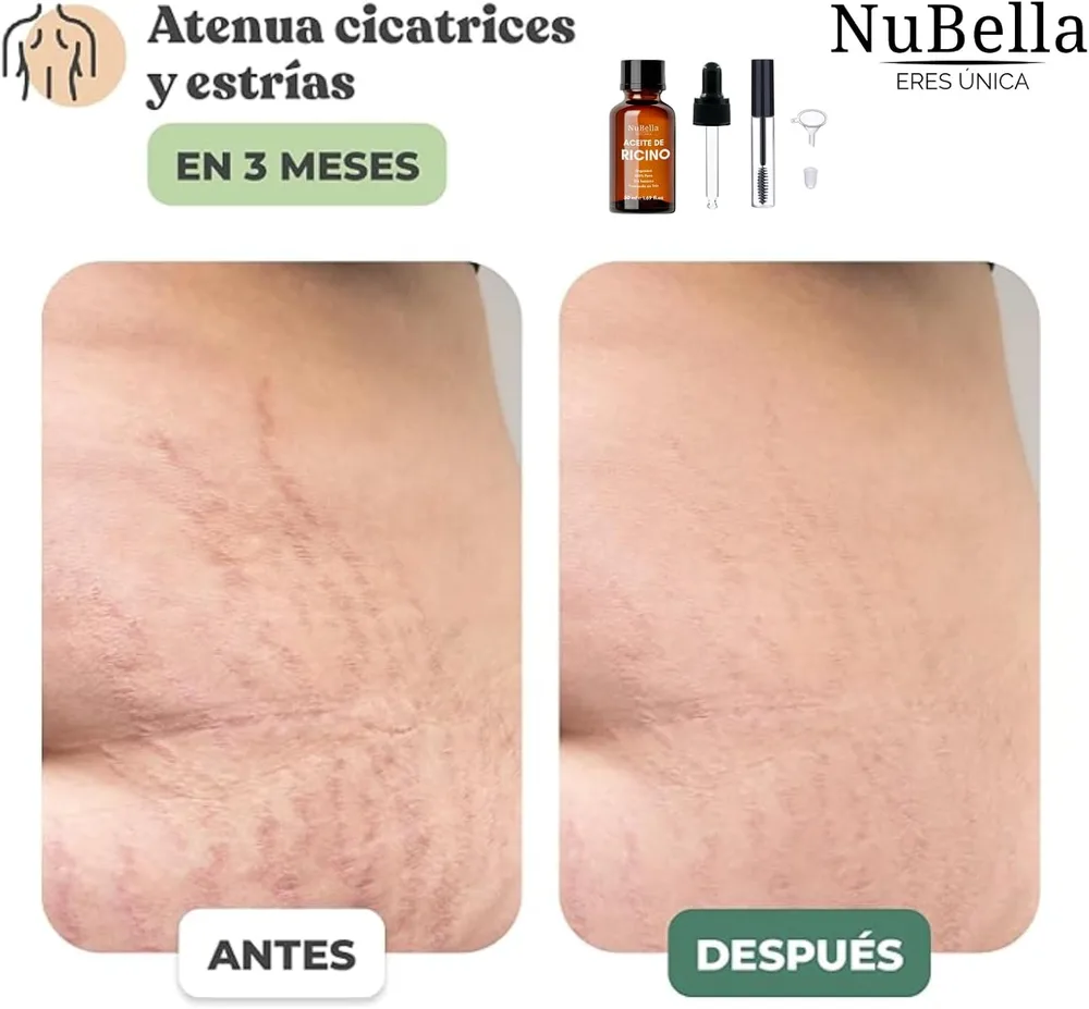 Aceite de Ricino — foto 3