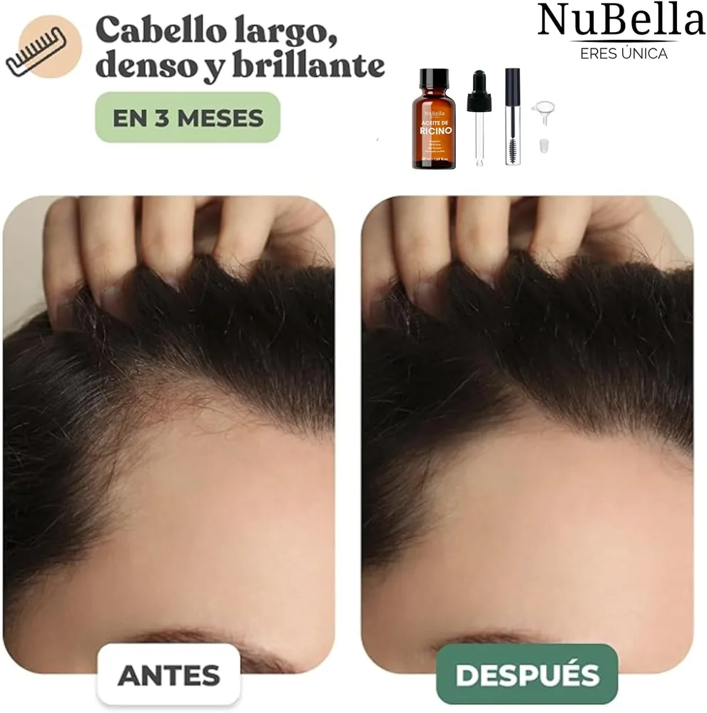 Aceite de Ricino — foto 5